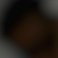 абцвотер-фри Голая