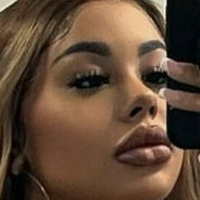 Шантилaпара Голая